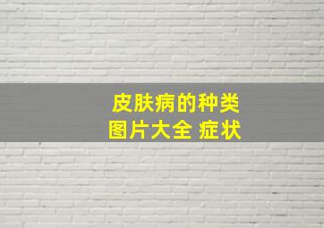 皮肤病的种类图片大全 症状